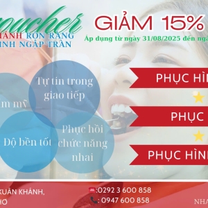 gift-voucher-15-danh-cho-phuc-hinh-le-quoc-khanh-2-thang-9
